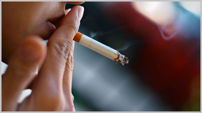 merokok sebagai penyebab perkembangan vena varikos