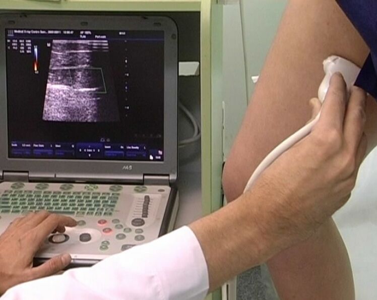 diagnosis ultrasound urat varikos pelvis