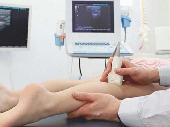 ultrasound urat bahagian bawah kaki