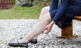 simptom urat varikos pada kaki pada wanita
